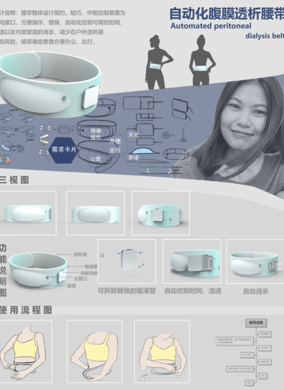 自动化覆膜透析腰带